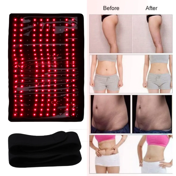 YD004 High-Power Red Light Warp with 210 LEDs for Body Therapy - Image 3